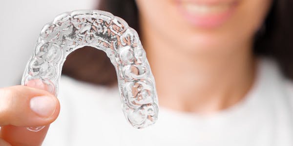 Clear Aligners Toronto
