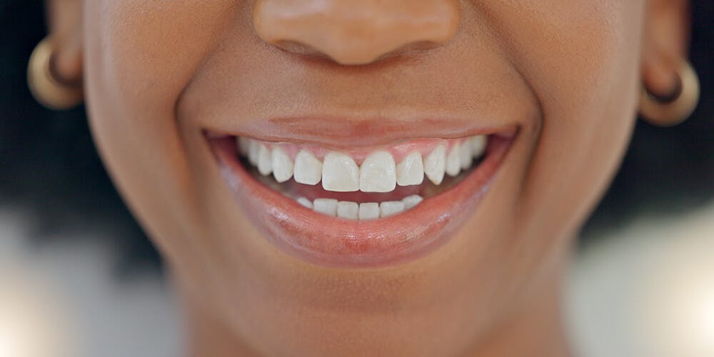 Symptoms suggesting that you need a bone graft for a dental implant